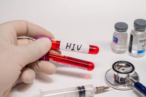 ​Hiv, Aids